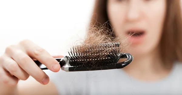 Caidac de cabello
